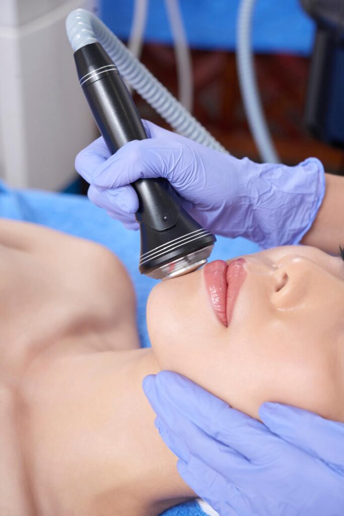 Ultraschallbehandlung an Kinn und Gesicht